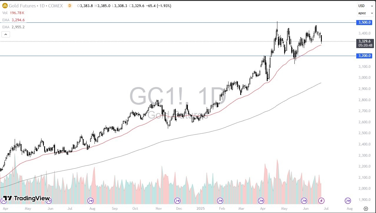 【XM Market Analysis】--Gold Forecast: Continues to See Volatility(图1)